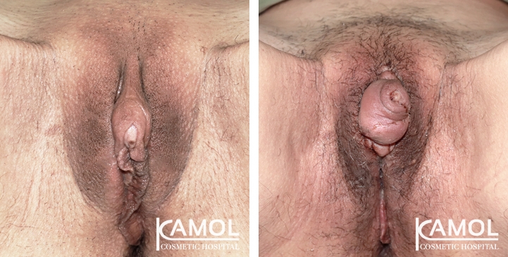 lg-65097791a5f5a-image