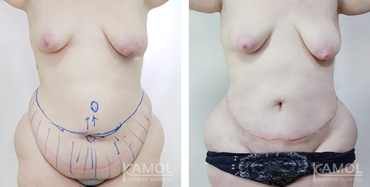 lg-675427e21f133-image