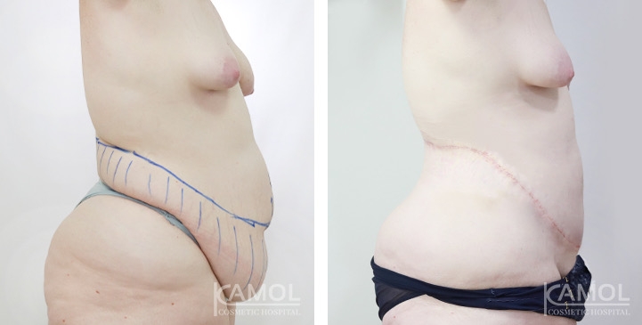 lg-675427e29fdb4-image