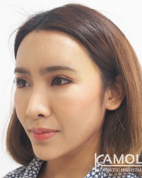 33876d373aef9c3728678a26b88dbddd1e61950b