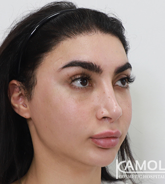 a74e83a24fa1f6b2a755ba0f9aeb132567722c8c