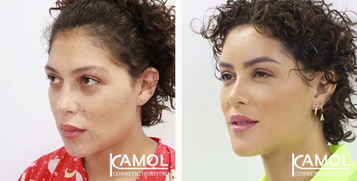 lg-64949589877f2-image