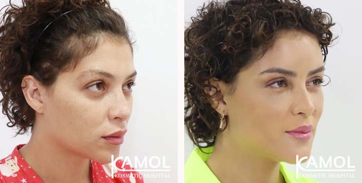 lg-649495898940b-image