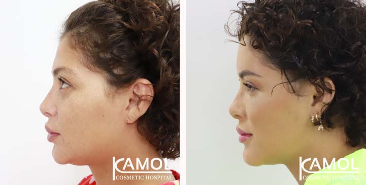 lg-649495898b1db-image