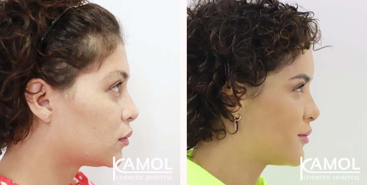 lg-649495898cf23-image