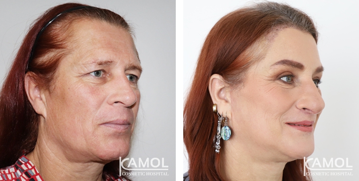 lg-649495899a167-image