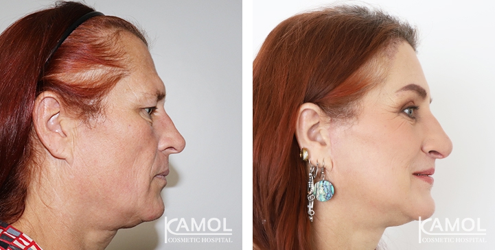 lg-649495899c3e0-image