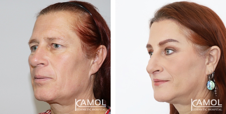 lg-649495899e497-image