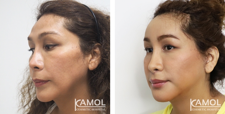 lg-64949589d2361-image