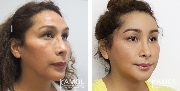 lg-64949589d8098-image