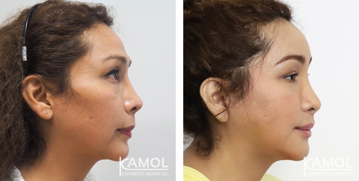 lg-64949589da013-image