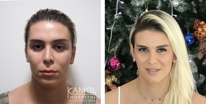 lg-64949589dcb82-image