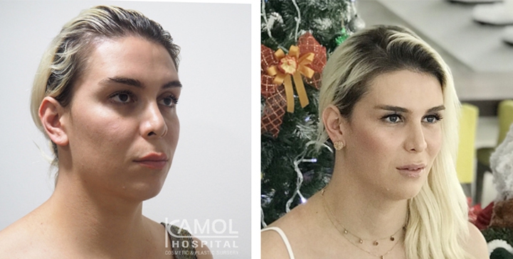 lg-64949589e0bee-image