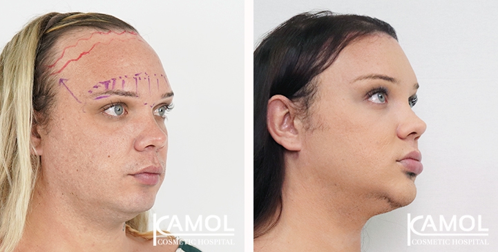 lg-6494958a00782-image