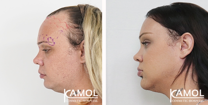 lg-6494958a06ac3-image