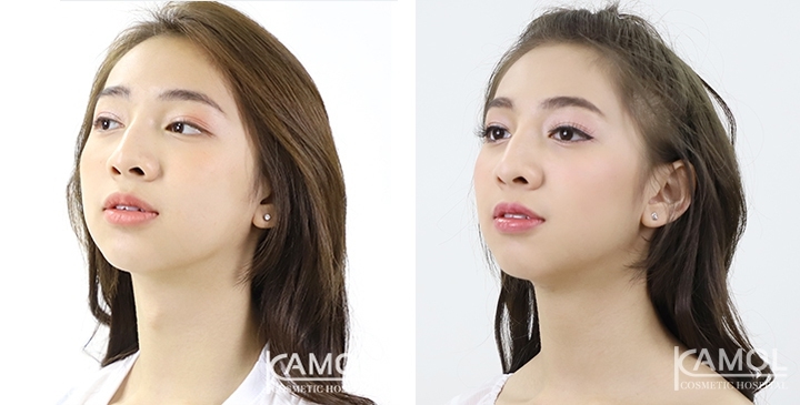 lg-6494958a4ce47-image