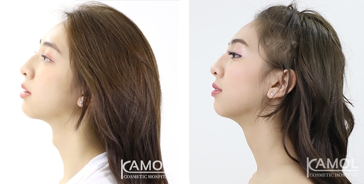 lg-6494958a4ece0-image