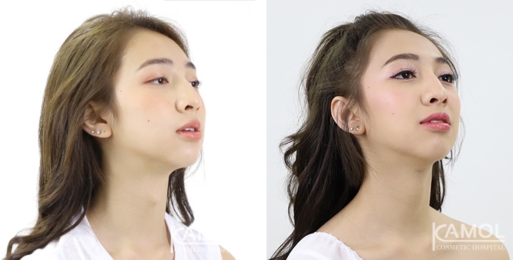 lg-6494958a50aaf-image