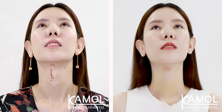 lg-6494958a55214-image