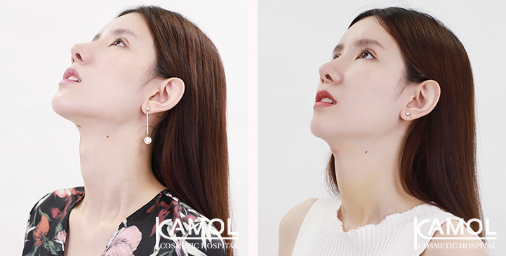 lg-6494958a56f45-image