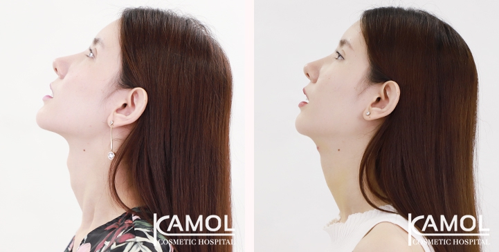 lg-6494958a58d52-image