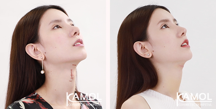 lg-6494958a5aed8-image