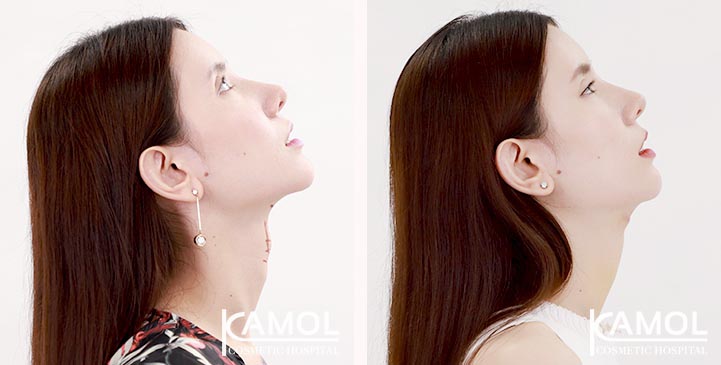 lg-6494958a5cebc-image