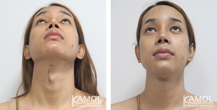 lg-6494958a5fa33-image