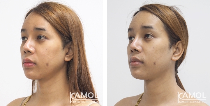 lg-6494958a61c1d-image