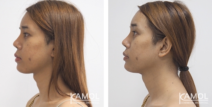 lg-6494958a6396b-image