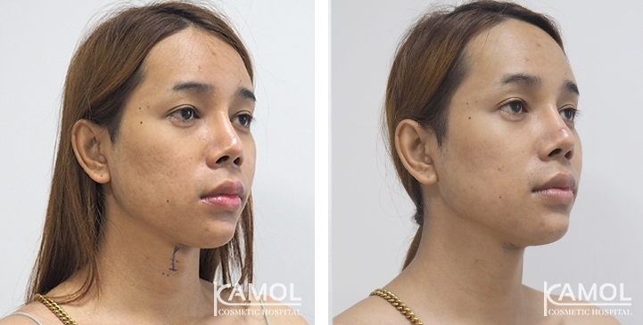 lg-6494958a656b5-image