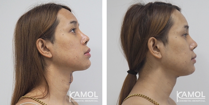 lg-6494958a6753c-image