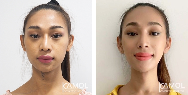 lg-6494958a6a5ff-image