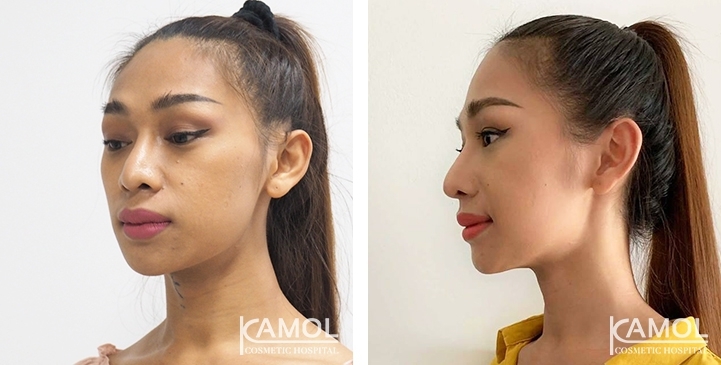 lg-6494958a6c649-image