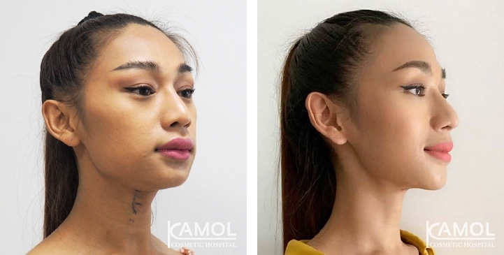 lg-6494958a6e607-image