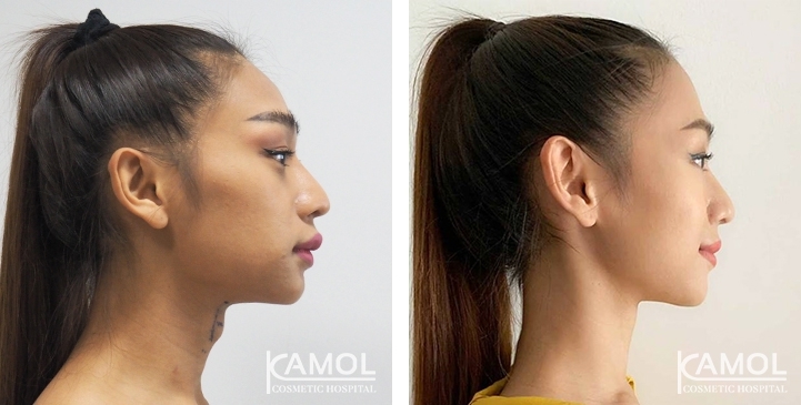 lg-6494958a705f2-image