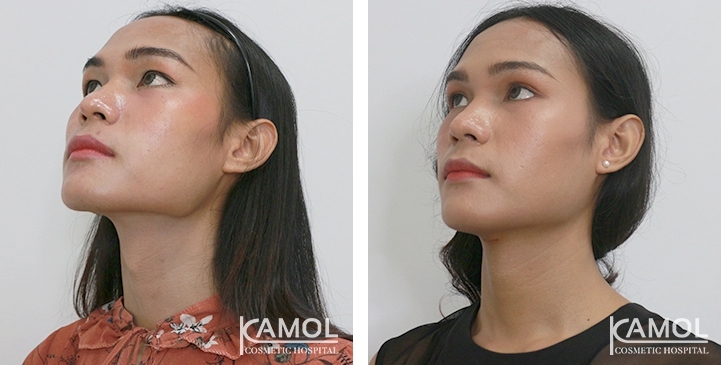 lg-6494958a75325-image