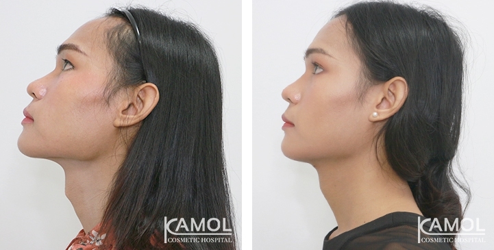 lg-6494958a77180-image