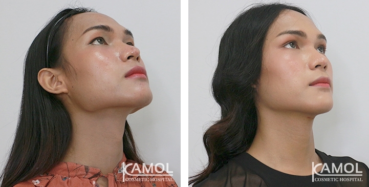 lg-6494958a7920f-image