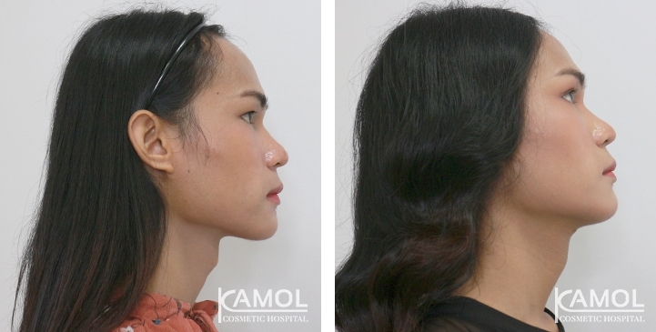 lg-6494958a7b41b-image