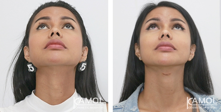 lg-6494958a7de85-image