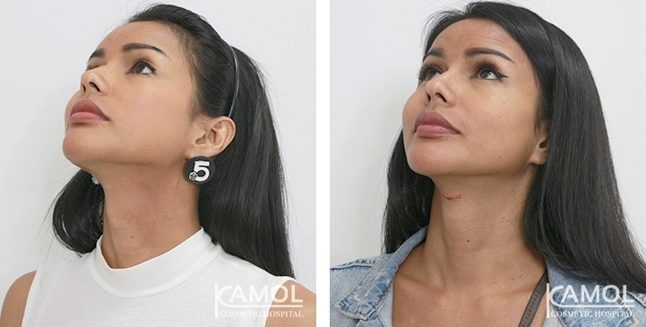 lg-6494958a7fde3-image