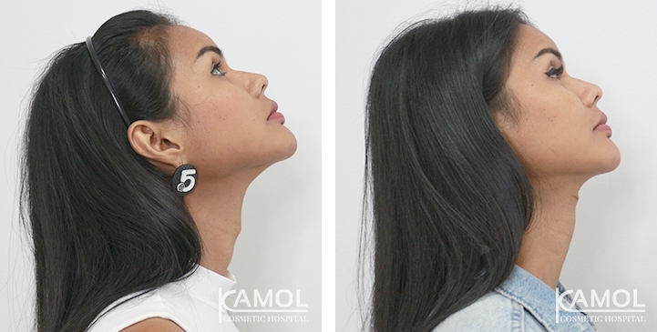 lg-6494958a85a42-image