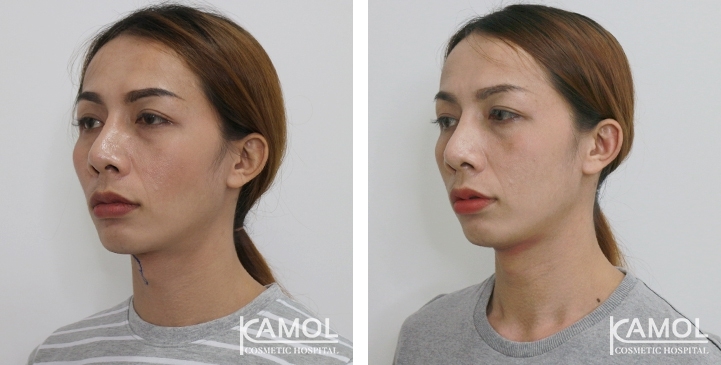 lg-6494958a8b315-image