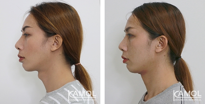 lg-6494958a8da2e-image