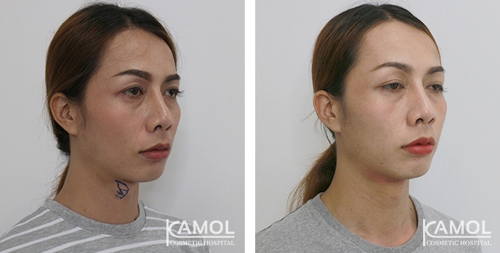 lg-6494958b268cf-image