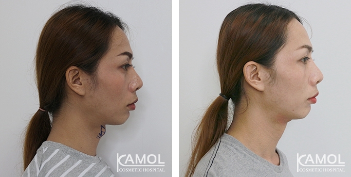 lg-6494958d67b8f-image