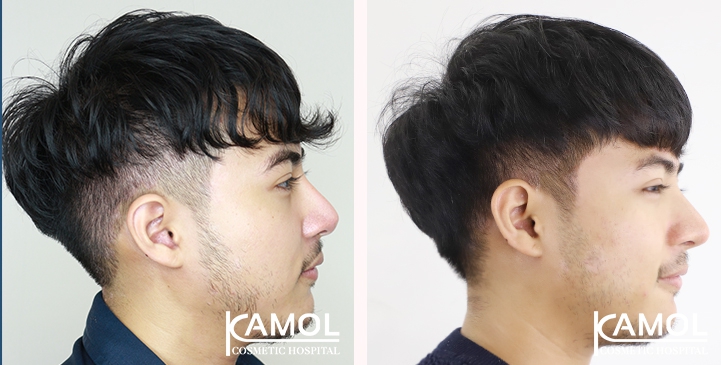 lg-6494958dcf0c1-image