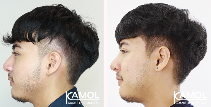 lg-6494958dd306b-image