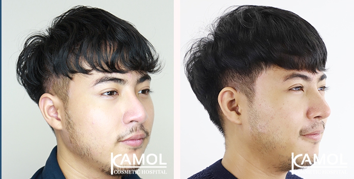 lg-6494958e080da-image